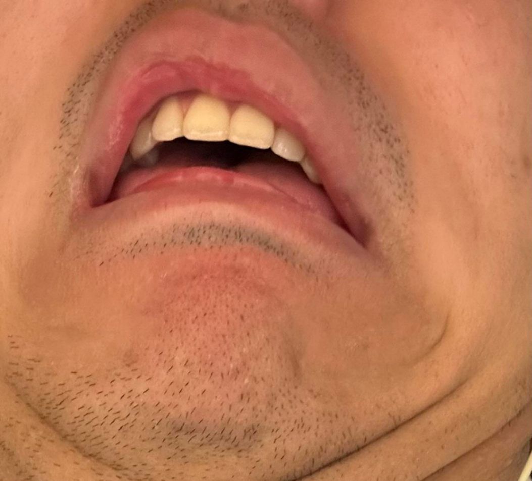 UMA漫才